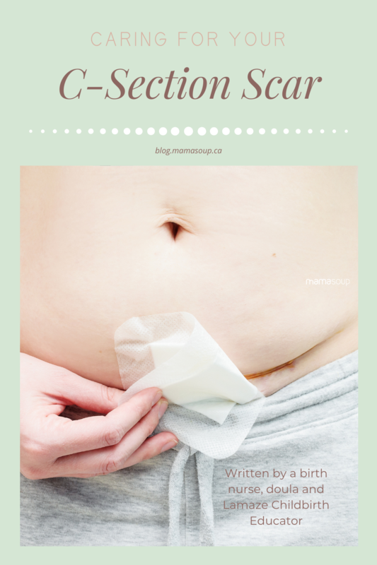 Nurse, doula, Lamaze childbirth educator and mom of four outlines what to expect when you first see your csection scar, how to care for it and when to call the doctor after you go home