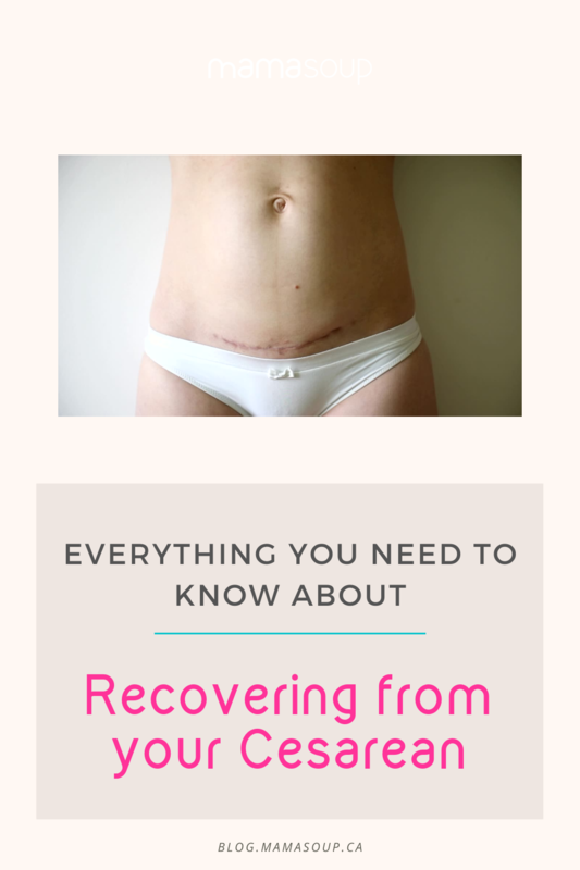 What to expect when you're recovering from a csection
